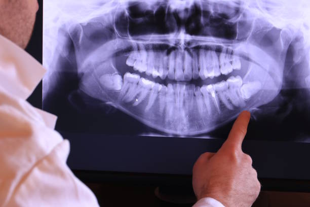 Best After-Hours Emergency Dentist in Mill City, OR